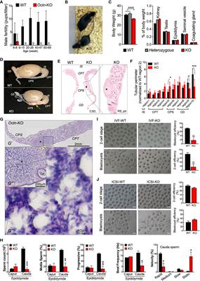 Epididymal epithelial degeneration and lipid metabolism impairment account for male infertility in occludin knockout mice